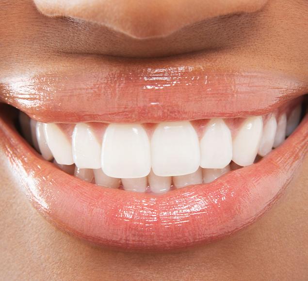 What is Cosmetic Dentistry | Family Dentistry | RC Dental | NW Calgary Dentist