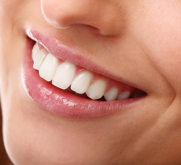 What is Cosmetic Dentistry | Family Dentistry | RC Dental | NW Calgary Dentist