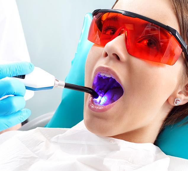 what-is-dental-bonding-cosmetic-tooth-bonding-rc-dental-general-family-dentist-nw-calgary-alberta Cosmetic Tooth Bonding | Family Dentistry | RC Dental | NW Calgary Dentist